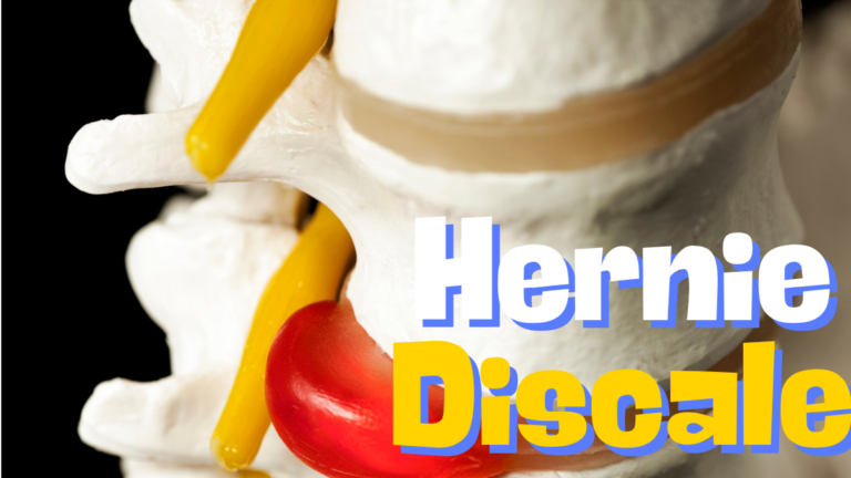 hernie discale
