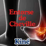 entorse de cheville
