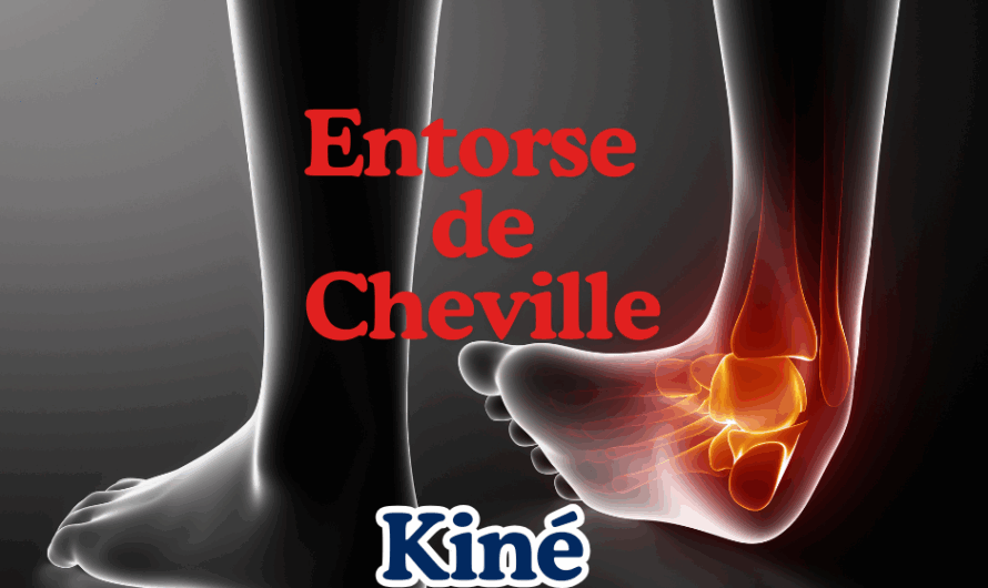 L’entorse de cheville : une pathologie fréquente, encore trop sous-estimée