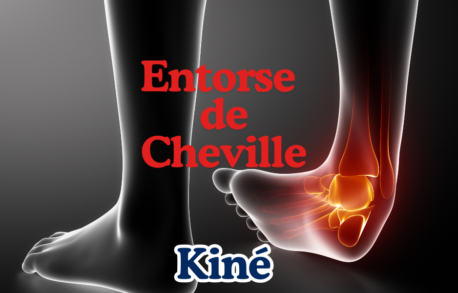 entorse de cheville